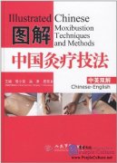 Illustrated Chinese Moxibustion Techniques and Methods