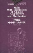 Skills with Illustrations of Chinese Acupuncture and Moxibustion (Chinese-English Edition)