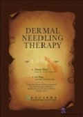 Dermal Needling Therapy 