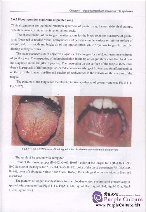 Sample pages of Tongue Diagnostics (ISBN:9787507737363)