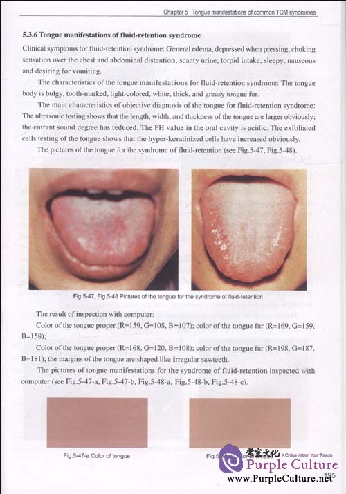 Sample pages of Tongue Diagnostics (ISBN:9787507737363)