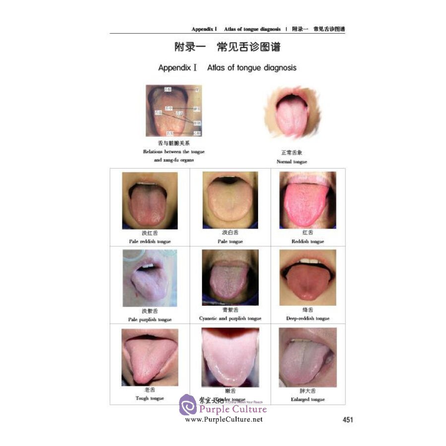 Sample pages of Diagnostics of Traditional Chinese Medicine and Treatment for Some Common Diseases (ISBN:9787534998294)