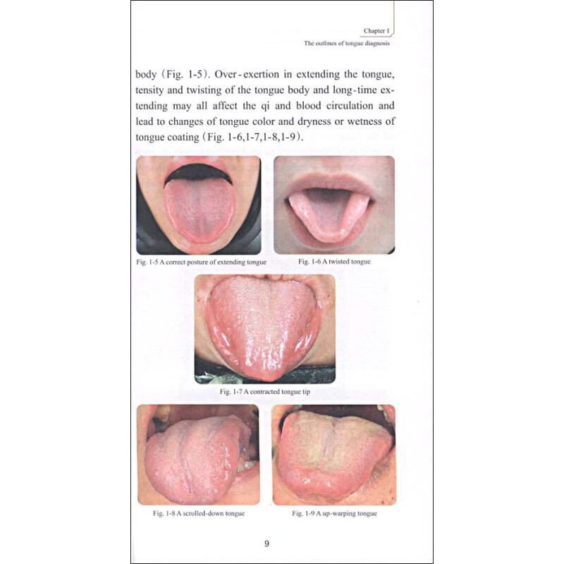 Sample pages of Fast Track to Traditional Chinese Medicine: Illustrations of Tongue Diagnosis (ISBN:9787532399529)