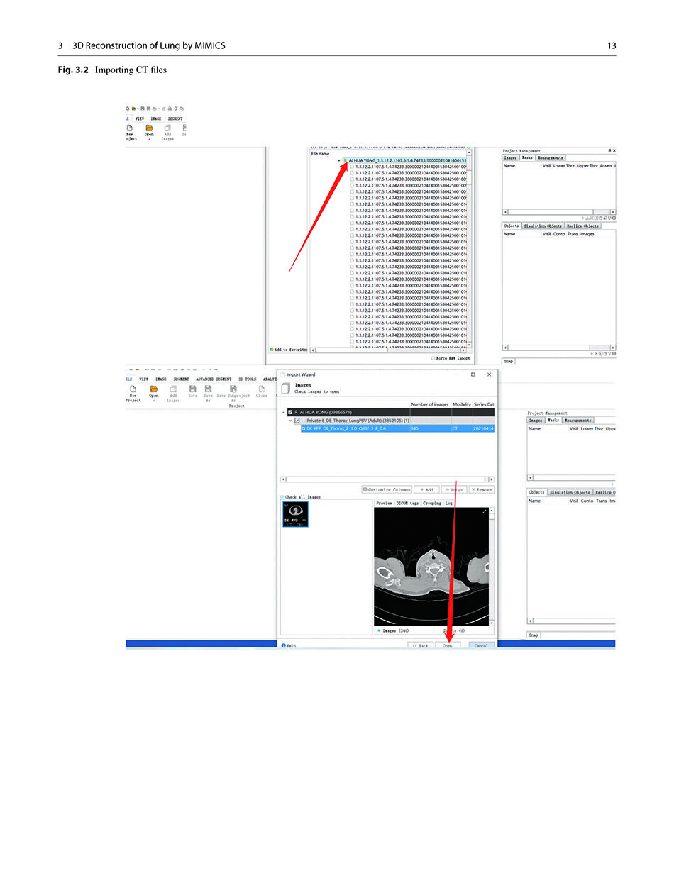 Sample pages of Segmentectomy for Early-Stage Lung Cancer 3D Navigation (ISBN:9787523508152)
