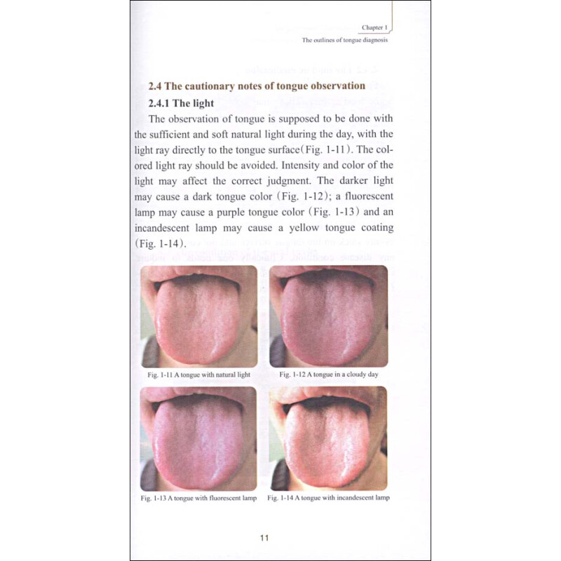 Sample pages of Fast Track to Traditional Chinese Medicine: Illustrations of Tongue Diagnosis (ISBN:9787532399529)