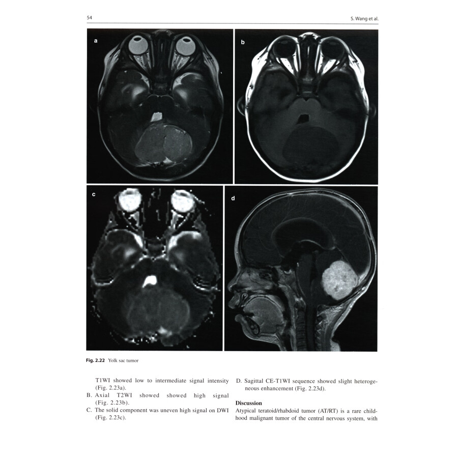 Sample pages of Pediatric Neuroimaging： Cases and Illustrations (ISBN:9787117342209)