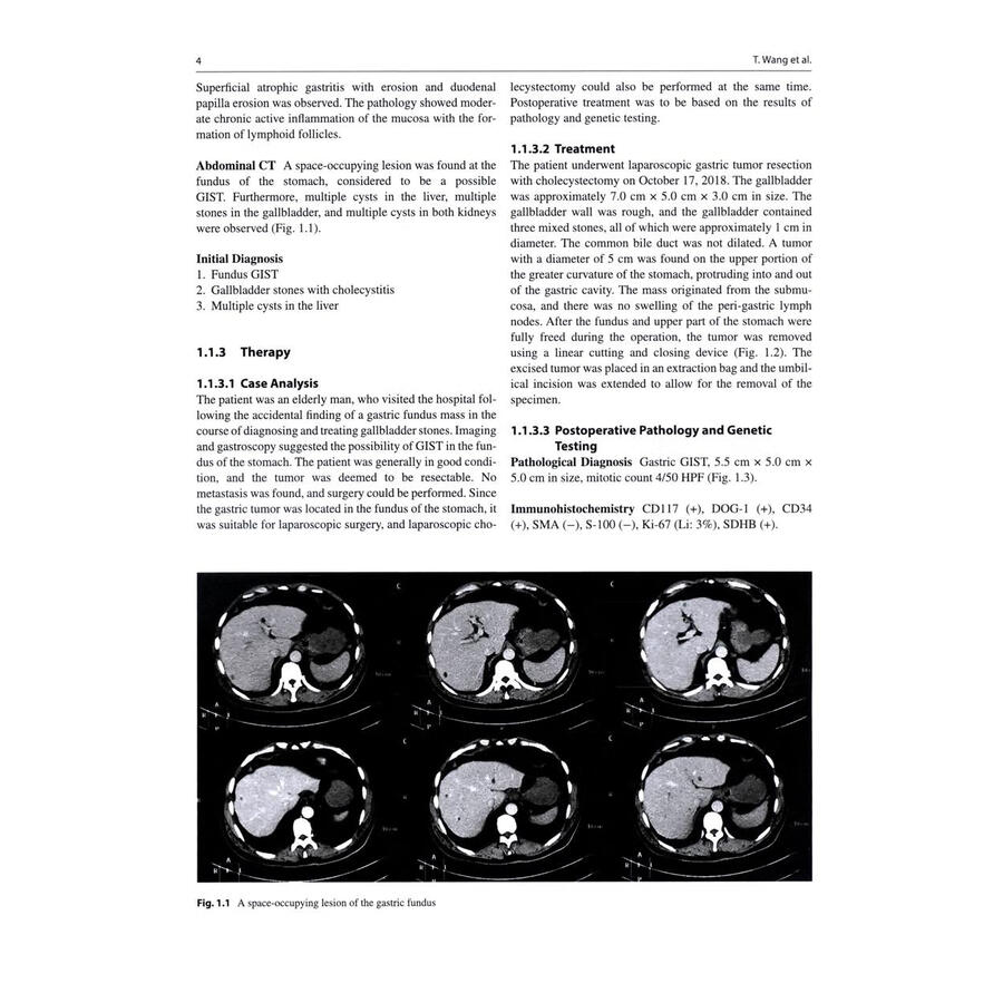 Sample pages of Clinical Management of Gastrointestinal Stromal Tumor (ISBN:9787117379939)