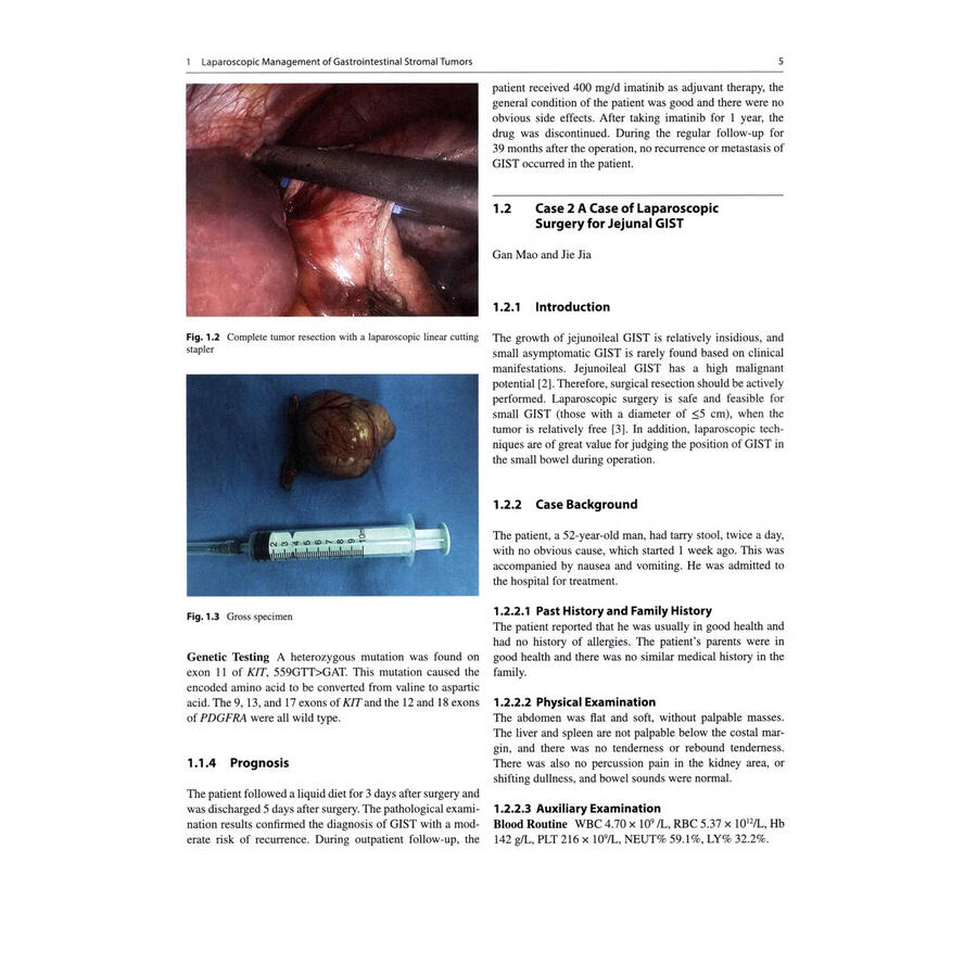 Sample pages of Clinical Management of Gastrointestinal Stromal Tumor (ISBN:9787117379939)