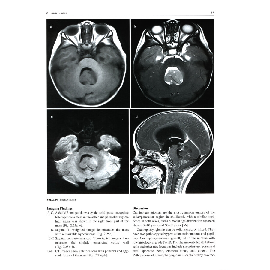Sample pages of Pediatric Neuroimaging： Cases and Illustrations (ISBN:9787117342209)
