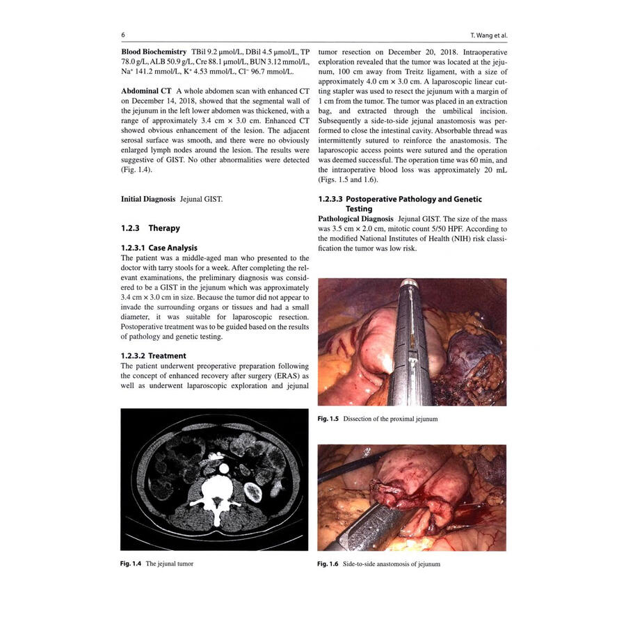 Sample pages of Clinical Management of Gastrointestinal Stromal Tumor (ISBN:9787117379939)