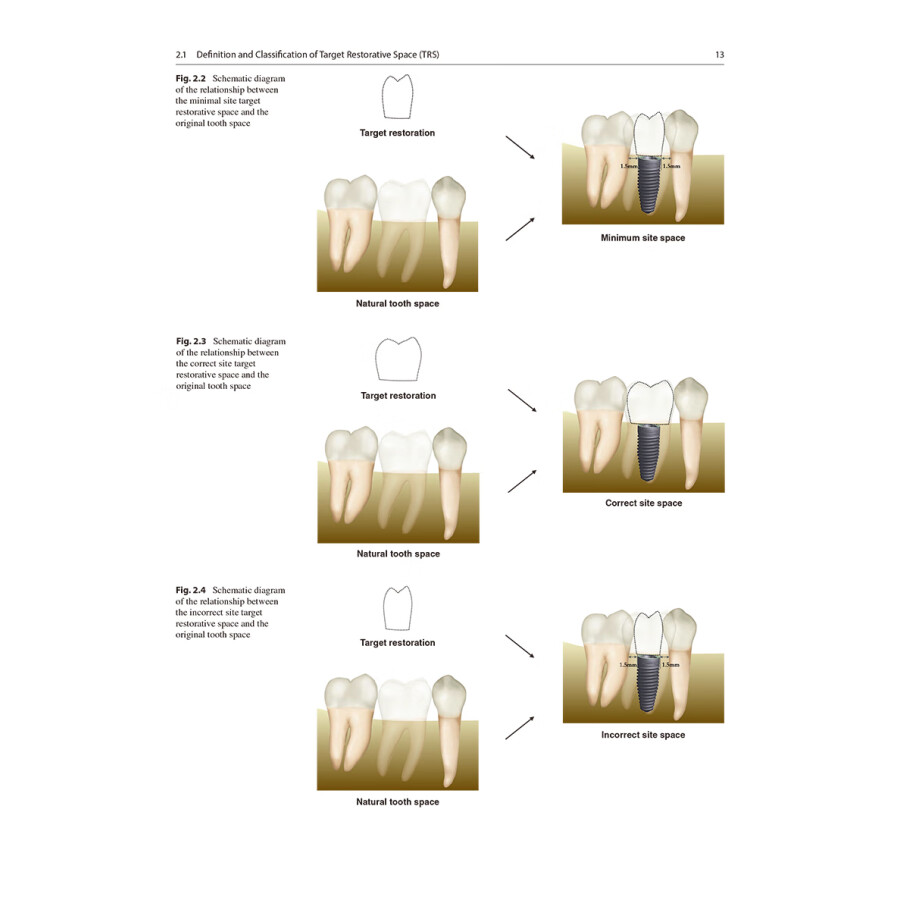 Sample pages of Digital Guided Micro Prosthodontics (ISBN:9787117339858)