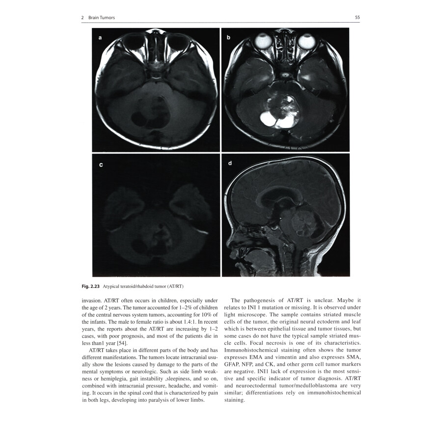 Sample pages of Pediatric Neuroimaging： Cases and Illustrations (ISBN:9787117342209)